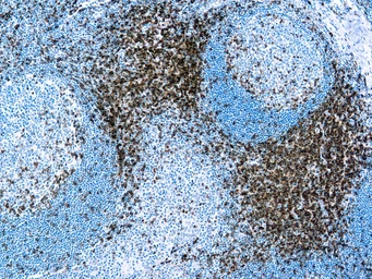 Anti-CD3 antibody [F7.2.38] used in IHC (Paraffin sections) (IHC-P). GTX17143
