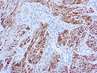 Anti-Desmin antibody [D33] used in IHC (Paraffin sections) (IHC-P). GTX17156