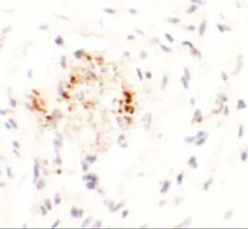 Anti-LEMD3 antibody used in IHC (Paraffin sections) (IHC-P). GTX17158