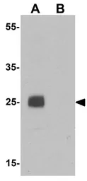 Anti-EMX1 antibody used in Western Blot (WB). GTX17163