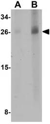 Anti-EMX2 antibody used in Western Blot (WB). GTX17164