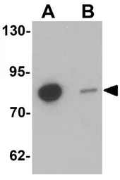 Anti-GBP6 antibody used in Western Blot (WB). GTX17166