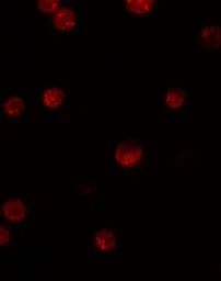 Anti-GBP6 antibody used in Immunocytochemistry/ Immunofluorescence (ICC/IF). GTX17166