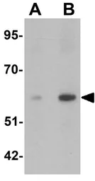 Anti-Angiopoietin 2 antibody used in Western Blot (WB). GTX17167