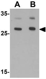 Anti-AIG1 antibody used in Western Blot (WB). GTX17168