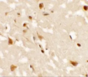 Anti-AIG1 antibody used in IHC (Paraffin sections) (IHC-P). GTX17168