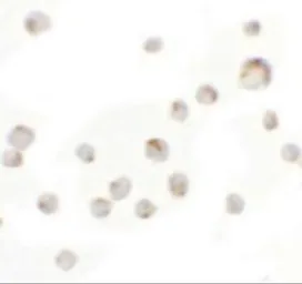 Anti-WDR5 antibody used in Immunocytochemistry/ Immunofluorescence (ICC/IF). GTX17169