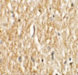 Anti-PHOX2A antibody used in IHC (Paraffin sections) (IHC-P). GTX17170