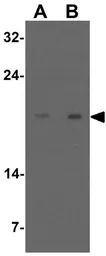 Anti-SDHAF1 antibody used in Western Blot (WB). GTX17172