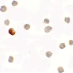 Anti-SDHAF1 antibody used in Immunocytochemistry/ Immunofluorescence (ICC/IF). GTX17172