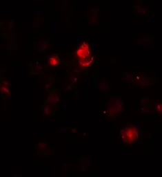 Anti-SDHAF1 antibody used in Immunocytochemistry/ Immunofluorescence (ICC/IF). GTX17172