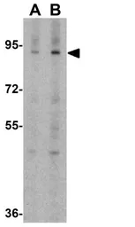 Anti-APBA1 antibody used in Western Blot (WB). GTX17173