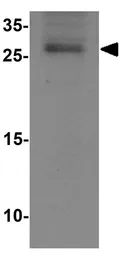 Anti-RAB21 antibody used in Western Blot (WB). GTX17174