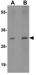 Anti-VAMP7 antibody used in Western Blot (WB). GTX17175