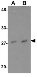 Anti-NDFIP1 antibody used in Western Blot (WB). GTX17176