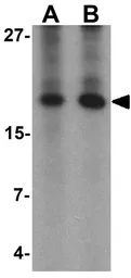 Anti-Angiogenin antibody used in Western Blot (WB). GTX17177