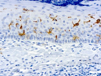 Anti-CD1a antibody [O10] used in IHC (Paraffin sections) (IHC-P). GTX17186