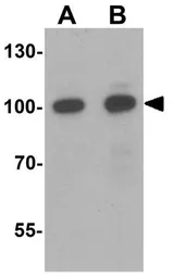 Anti-SIDT2 antibody used in Western Blot (WB). GTX17188
