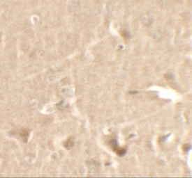 Anti-Cyclin T1 antibody used in IHC (Paraffin sections) (IHC-P). GTX17200