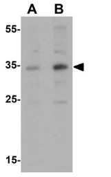 Anti-Apolipoprotein E antibody used in Western Blot (WB). GTX17206