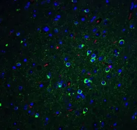 Anti-Apolipoprotein E antibody used in IHC (Paraffin sections) (IHC-P). GTX17206