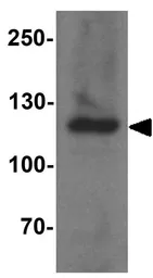 Anti-ERAP2 antibody used in Western Blot (WB). GTX17208