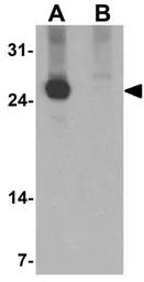 Anti-CD160 antibody used in Western Blot (WB). GTX17209