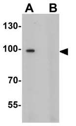 Anti-ITCH antibody used in Western Blot (WB). GTX17213