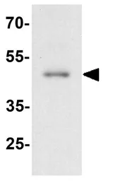 Anti-APOBEC3B antibody used in Western Blot (WB). GTX17214
