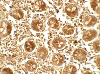 Anti-APOBEC3B antibody used in IHC (Paraffin sections) (IHC-P). GTX17214