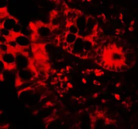 Anti-APOBEC3B antibody used in IHC (Paraffin sections) (IHC-P). GTX17214