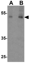 Anti-ANGPTL3 antibody used in Western Blot (WB). GTX17219