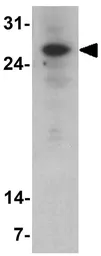 Anti-PRRX1 antibody used in Western Blot (WB). GTX17237