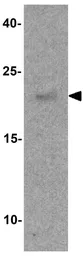 Anti-SPIB antibody used in Western Blot (WB). GTX17242