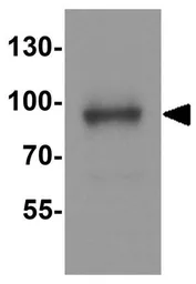 Anti-PACS2 antibody used in Western Blot (WB). GTX17244