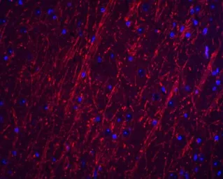 Anti-PACS2 antibody used in IHC (Paraffin sections) (IHC-P). GTX17244