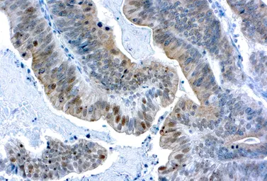 Anti-BRCA1 antibody [GLK-2] used in IHC (Paraffin sections) (IHC-P). GTX17251