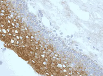 Anti-NLRP3 antibody [nalpy3-b] used in IHC (Frozen sections) (IHC-Fr). GTX17267