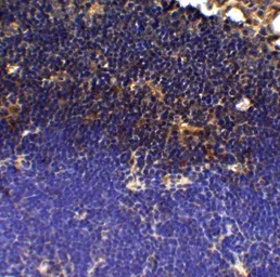 Anti-PD1 antibody [12A7D7] used in IHC (Paraffin sections) (IHC-P). GTX17273