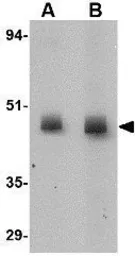 Anti-CD4 antibody [8G1B12] used in Western Blot (WB). GTX17283