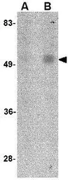 Anti-Orai1 antibody [6D11A11] used in Western Blot (WB). GTX17289