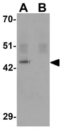 Anti-KLF4 antibody [4G6E11] used in Western Blot (WB). GTX17300