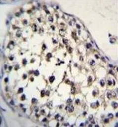 Anti-FUT8 antibody used in IHC (Paraffin sections) (IHC-P). GTX17311