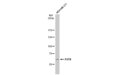 Anti-FUT8 antibody used in Western Blot (WB). GTX17311