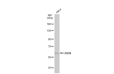 Anti-FUT8 antibody used in Western Blot (WB). GTX17311