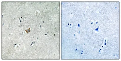 Anti-EphA3 (phospho Tyr779) / EphA4 (phospho Tyr779) / EphA5 (phospho Tyr833) antibody used in IHC (Paraffin sections) (IHC-P). GTX17348