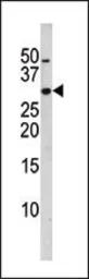 Anti-p27 Kip1 (phospho Ser10) antibody used in Western Blot (WB). GTX17353