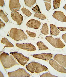 Anti-p27 Kip1 (phospho Ser10) antibody used in IHC (Paraffin sections) (IHC-P). GTX17353