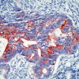 Anti-Secretory Component Glycoprotein antibody [0.N.556] used in IHC (Paraffin sections) (IHC-P). GTX17377