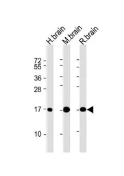 Anti-LC3A antibody [166AT1234] used in Western Blot (WB). GTX17380
